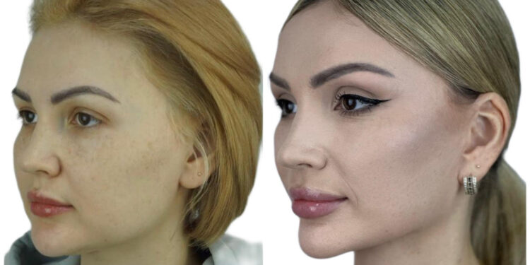 The Evolution of Aesthetic Harmony in Plastic Surgery by Dr. Daniyar Baibosunov